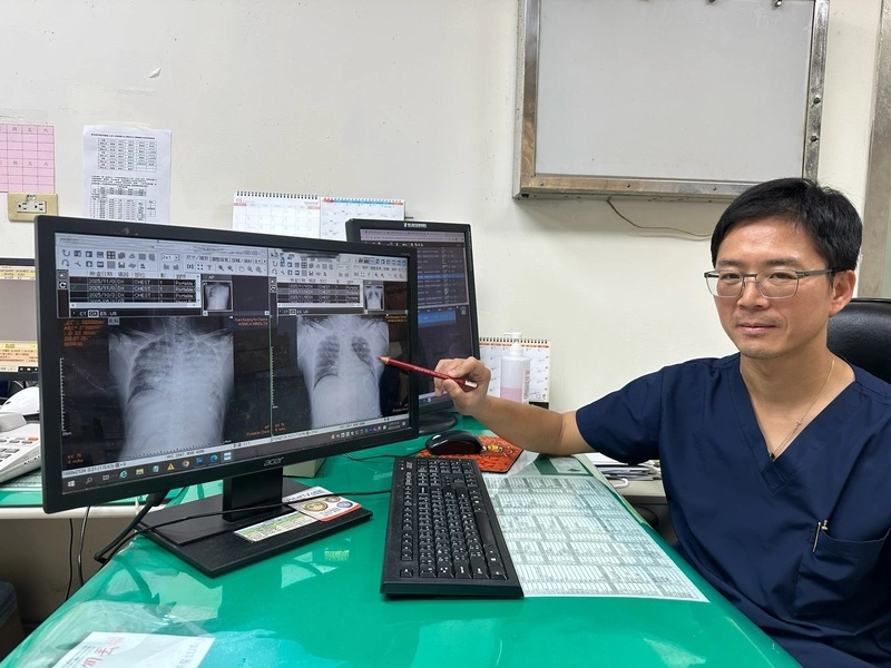 男子喝珍奶嗆咳昏迷　確診腦血管瘤破裂