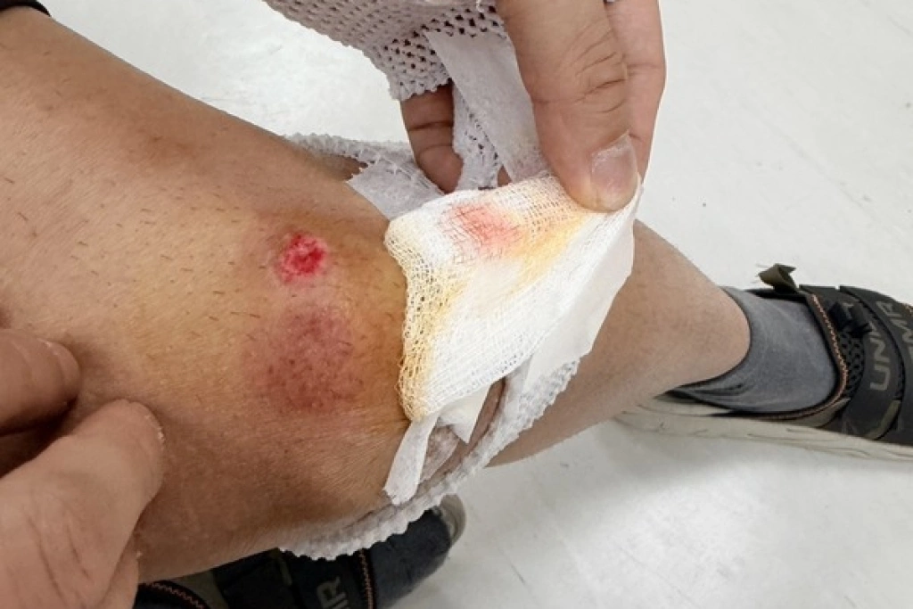 北市男通緝犯遇盤查逃逸　警方追捕負傷逮人