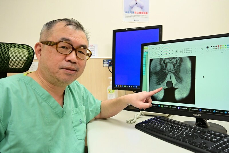 影響檢查發現手臂變粗　是脂肪瘤作祟