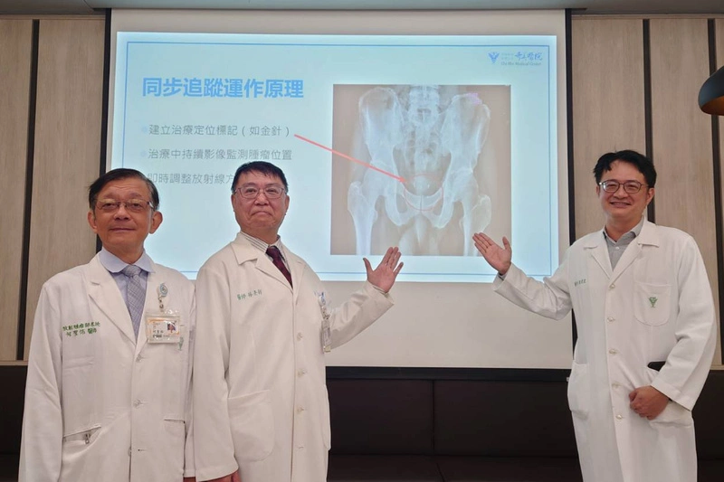 奇美醫新一代放療 金針即時定位除攝護腺腫瘤更精準