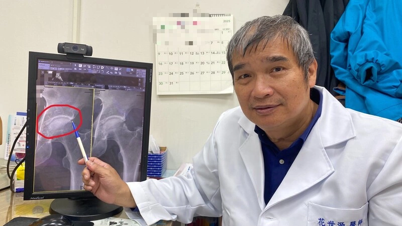 裝潢師傅罹患髖關節夾擊症候群　醫師說明個案