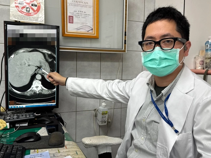 患者因嗜甜罹患重度脂肪肝　醫師籲均衡飲食