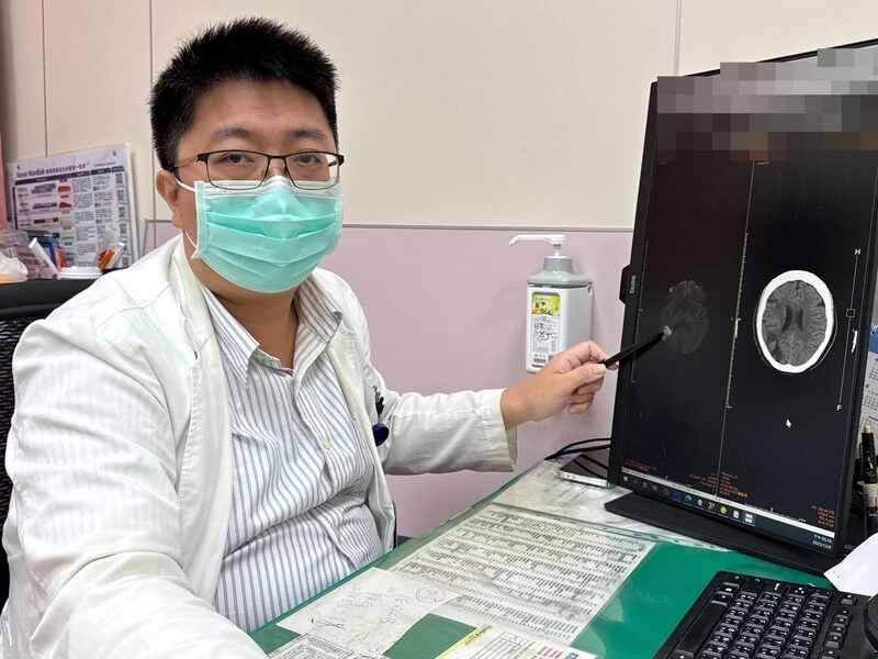 台中6旬婦視力突模糊　醫：非典型中風