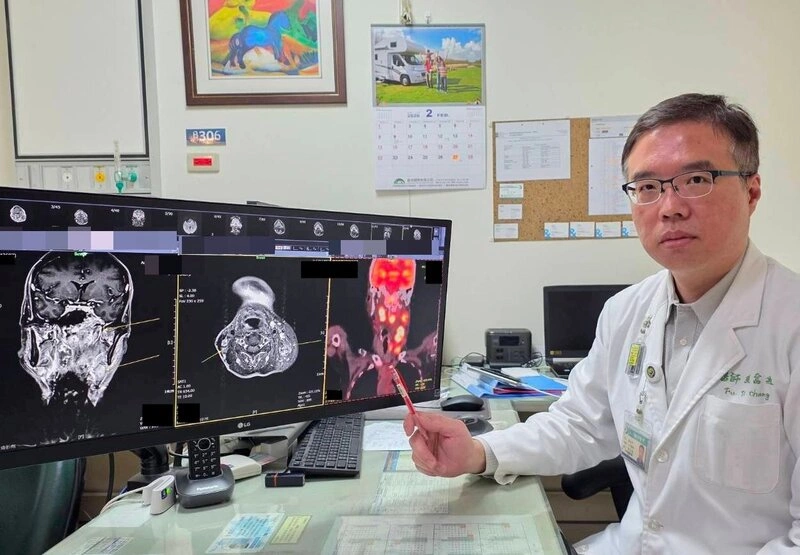 中年男耳鳴聽力下降　就醫才知鼻咽癌第三期